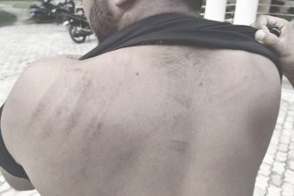 attack on journalist